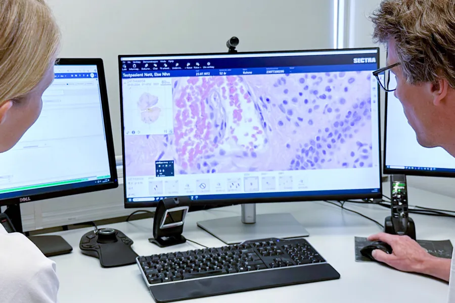 Mann og kvinne i legetøy ser på en dataskjerm som viser nærbilde av digitale vevsprøver. Foto.